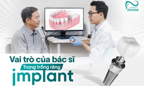 Top 5 bác sĩ có nhiều kinh nghiệm trong lĩnh vực trồng răng Implant tại Hà Nội
