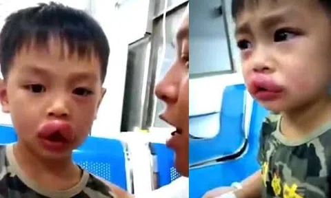 Muốn béo thì ghẹo ong