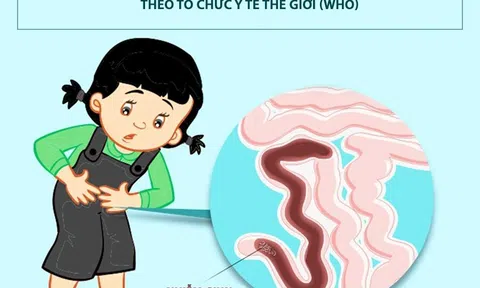Tẩy giun
