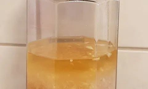 Tỏi ngâm rượu