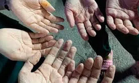 Cảm xúc đến bất chợt từ vết hằn trên bàn tay