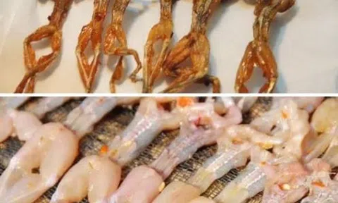 Vũ nữ chân dài