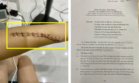 Hưng Yên: Sau “bức thư mực đỏ”, người mẹ trẻ gửi đơn tố giác, mong được giải quyết