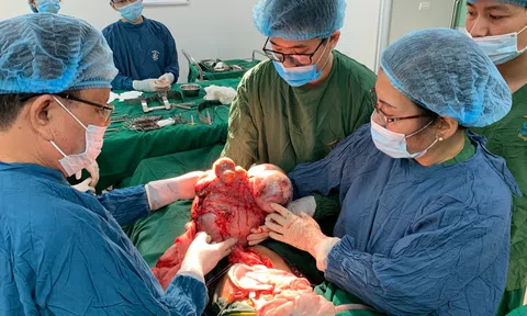 Tuyên Quang: Bệnh viện Phương Bắc phẫu thuật cắt bỏ khối u xơ tử cung gần 9,5 kg