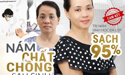 Nghệ An : Thẩm mỹ viện quốc tế Bắc Mỹ trị nám uy tín