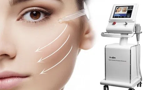 Top những công nghệ trẻ hóa da thịnh hành hiện nay