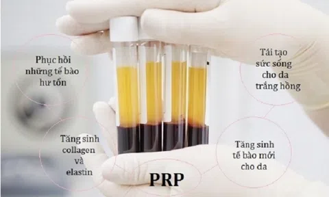 Trẻ hóa da PRP hiệu quả đến mức nào?