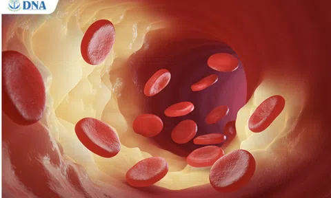 Bệnh viện Quốc tế DNA xét nghiệm miễn phí bộ mỡ máu tại Thành phố Hồ Chí Minh