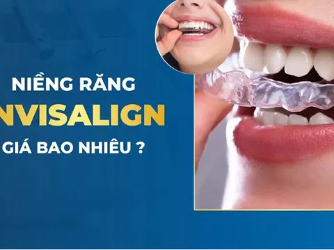 Niềng răng có tốt hay không?