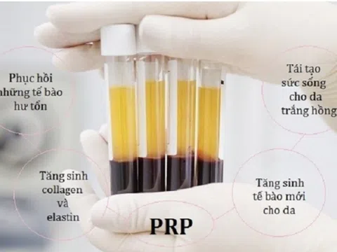 Trẻ hóa da PRP hiệu quả đến mức nào?