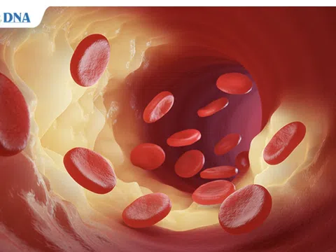 Bệnh viện Quốc tế DNA xét nghiệm miễn phí bộ mỡ máu tại Thành phố Hồ Chí Minh